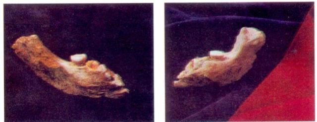 Нижняя челюсть первобытного человека,  обнаруженная в Азыхской пещере.
