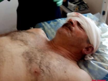 В результате обстрела армян ранен житель Агдама